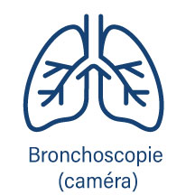 Guichet d'investigation rapide (GIR) - Bronchoscopie caméra