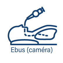 Guichet d'investigation rapide (GIR) - Ebus caméra